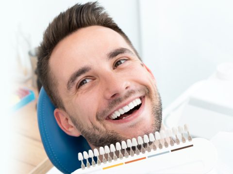 Can Dental Veneers Conceal Teeth Imperfections?