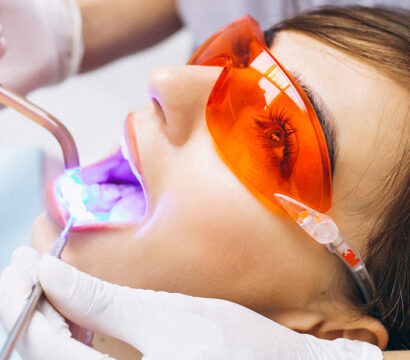 Precautions for Heart Patients During Teeth Whitening