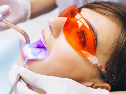 Precautions for Heart Patients During Teeth Whitening